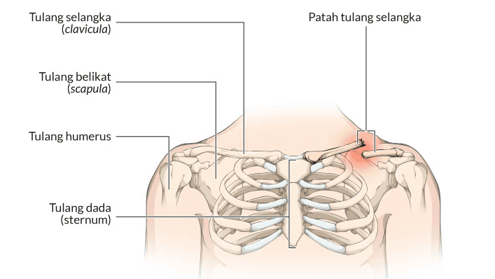 Tulang lengan atas Tulang pengumpil -Tulang hasta Tulang pergelangan tangan - Tulang telapak tangan Tulang jari tangan 
Tulang selangka (clavicula) Patah tulang selangka Tulang belikat (scapula) Tulang humerus Tulang dada (sternum) 