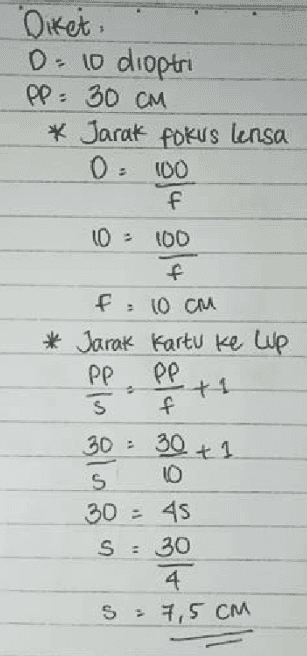 Diket: D-10 dioptri PP: 30 CM * Jarak fokus lensa 0:00 f 10 : 100 f F = 10cm Jarak Kartu ke Cup PP PP $ f 30 - s 10 30 : 45 S: 30 4 = 7,5CM 30 + 1 OP 