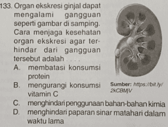 133. Organ ekskresi ginjal dapat mengalami gangguan seperti gambar di samping. Cara menjaga kesehatan organ ekskresi agar ter- hindar dari gangguan tersebut adalah A. membatasi konsumsi protein B. mengurangi konsumsi Sumber: https://bit.ly/ vitamin C 2KCBMV C. menghindari penggunaan bahan-bahan kimia D. menghindari paparan sinar matahari dalam waktu lama 