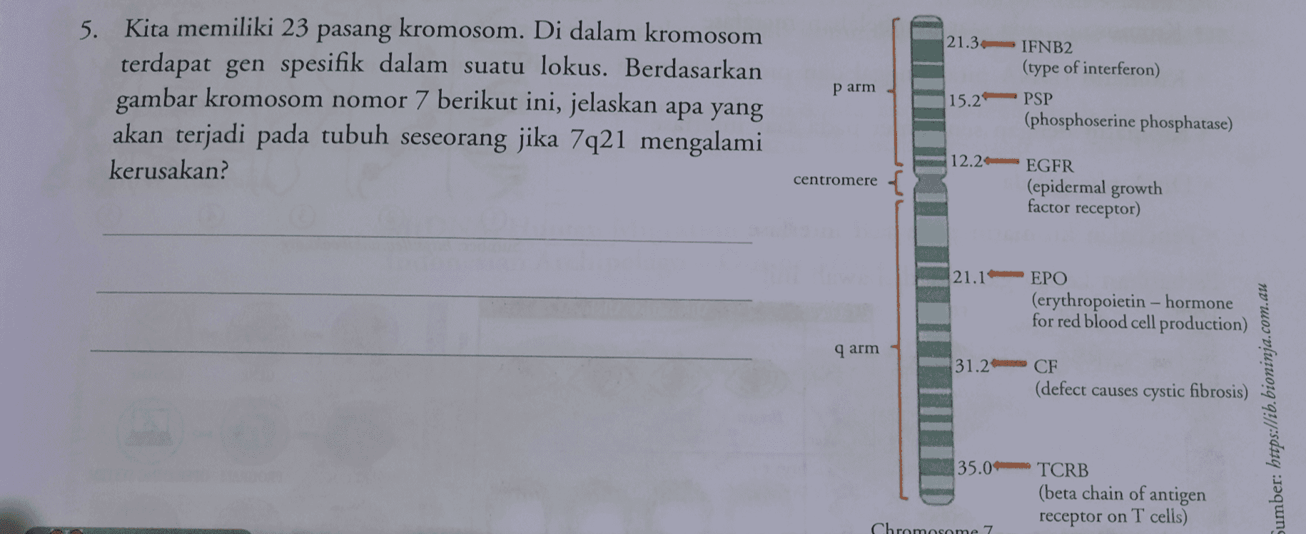 p arm 5. Kita memiliki 23 pasang kromosom. Di dalam kromosom terdapat gen spesifik dalam suatu lokus. Berdasarkan gambar kromosom nomor 7 berikut ini, jelaskan apa yang akan terjadi pada tubuh seseorang jika 7q21 mengalami kerusakan? 21.3 IFNB2 (type of interferon) 15.2 PSP (phosphoserine phosphatase) centromere 12.2 EGFR (epidermal growth factor receptor) 21.1 EPO (erythropoietin - hormone for red blood cell production) q arm 31.2 CF (defect causes cystic fibrosis) Sumber: https://ib.bioninja.com.au 35.0 TCRB (beta chain of antigen receptor on T cells) Chromosome 7 