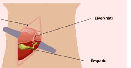 Liver/hati Empedu 