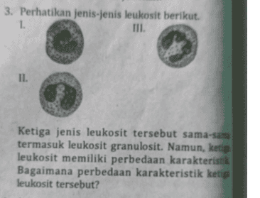 3. Perhatikan jenis-jenis leukosit berikut. 1. III. Post IL. Ketiga jenis leukosit tersebut sama-sama termasuk leukosit granulosit. Namun, ketig leukosit memiliki perbedaan karakteristik Bagaimana perbedaan karakteristik ketig leukosit tersebut? 