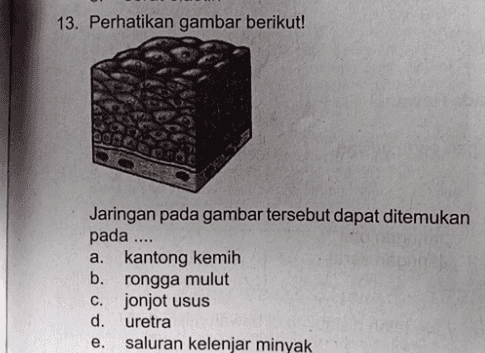 13. Perhatikan gambar berikut! Jaringan pada gambar tersebut dapat ditemukan pada .... a. kantong kemih b. rongga mulut c. jonjot usus d. uretra e. saluran kelenjar minyak 