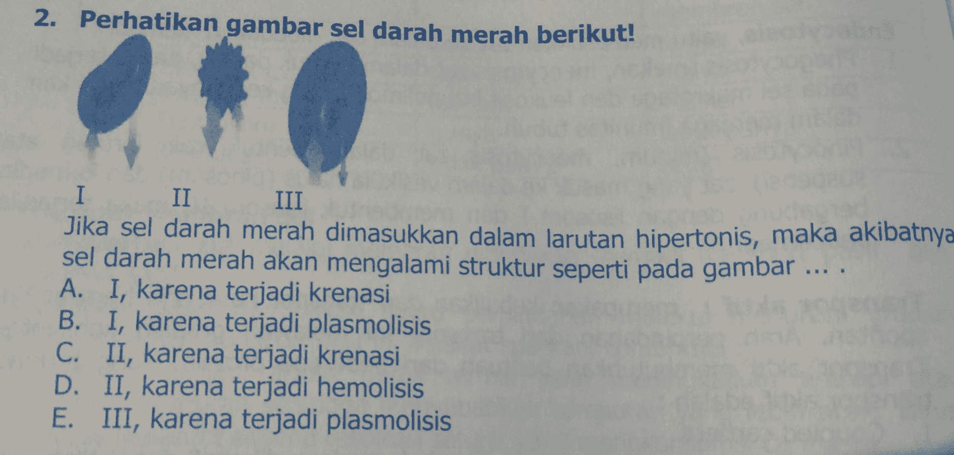 2. Perhatikan gambar sel darah merah berikut! I II III Jika sel darah merah dimasukkan dalam larutan hipertonis, maka akibatnya sel darah merah akan mengalami struktur seperti pada gambar ... . A. I, karena terjadi krenasi B. I, karena terjadi plasmolisis C. II, karena terjadi krenasi D. II, karena terjadi hemolisis E. III, karena terjadi plasmolisis 