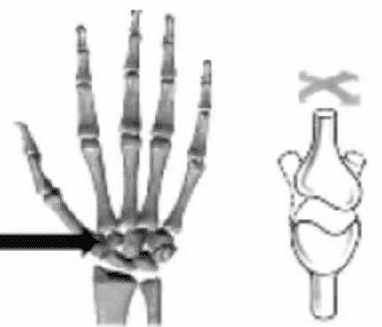 X Х 22 