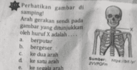 Perhatikan gambar di samping! Arah gerakan sendi pada gambar yang ditunjukkan oleh huruf X adalah a berputar b. bergeser c ke dua arah Sumber d ke satu arah WPOF e ke segala arah 