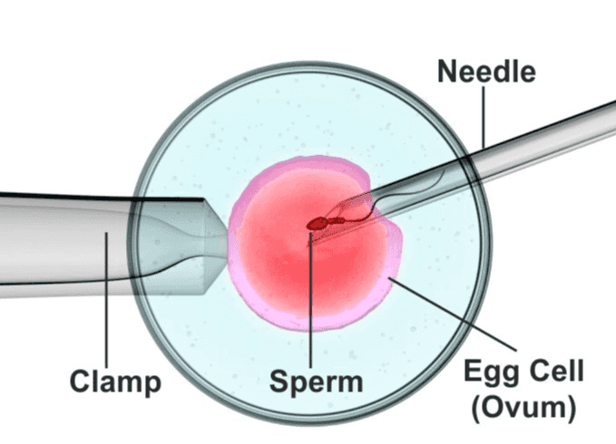 Needle Clamp Sperm Egg Cell (Ovum) 